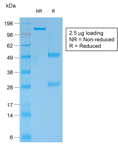 Data from SDS-PAGE analysis of Anti-Bcl-2 antibody (Clone rBCL2/796). Reducing lane (R) shows heavy and light chain fragments. NR lane shows intact antibody with expected MW of approximately 150 kDa. The data are consistent with a high purity, intact mAb.